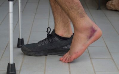Effect of a Sprained Ankle, What to expect from an Adjustment
